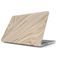 Burga Hardshell MacBook Air 13 Pouces (2022-2026) Coque - Full Glam - Model A2681 / A3113 / A3240 / A3449